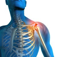 Shoulder Pain